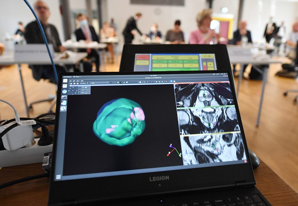 Termin im Universitätskrankenhaus Mannheim im Rahmen der Sommerreise „Einsatz und Nutzen der Schlüsseltechnologie KI In der Gesundheitswirtschaft“